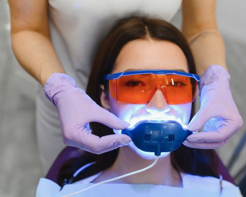 Dental Bleaching